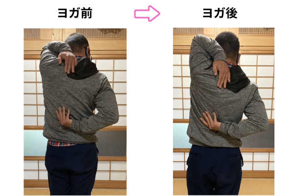 肩周りの柔軟性の変化